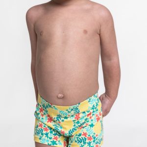 BOXER
